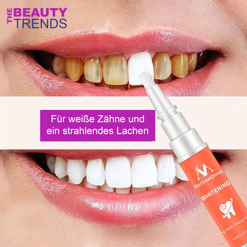 Zahnaufhellungsstift